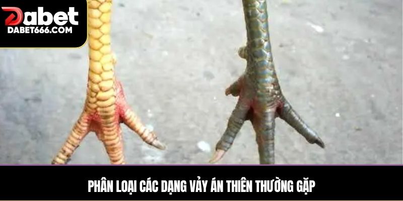 Phân loại các dạng vảy Án Thiên thường gặp